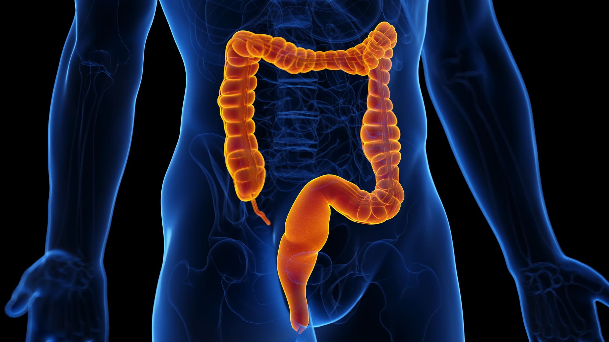 “I Was Sick of Flare-Ups Controlling My Life”: How a Highett Man Managed Ulcerative Colitis with Naturopathy